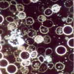 Dunkelfeld-Mikroskopie